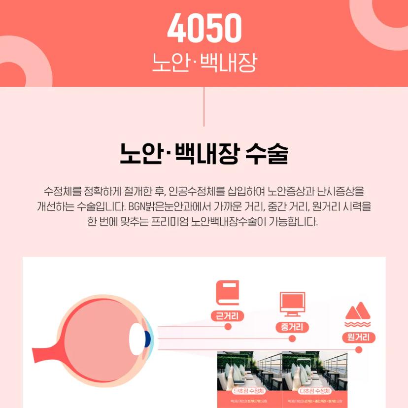 광주과학기술원 X 밝은눈안과